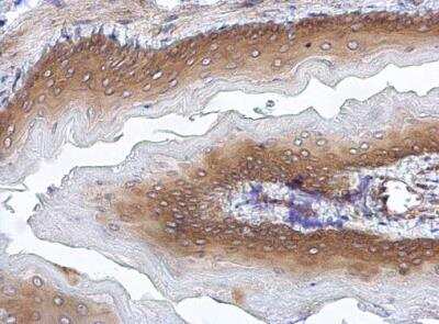 Immunohistochemistry-Paraffin: CHIP/STUB1 Antibody [NBP1-30936]