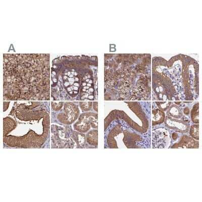 Immunohistochemistry-Paraffin: CHIP/STUB1 Antibody [NBP2-47509]