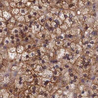 Immunohistochemistry-Paraffin: CHIP/STUB1 Antibody [NBP2-47509]