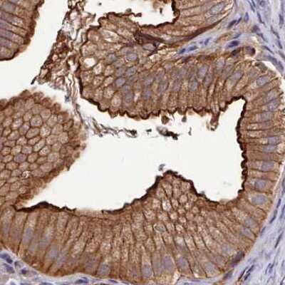 Immunohistochemistry-Paraffin: CHIP/STUB1 Antibody [NBP2-47509]