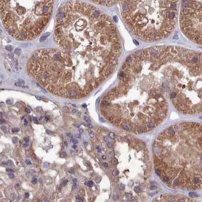 Immunohistochemistry-Paraffin: CHIP/STUB1 Antibody [NBP2-47509]