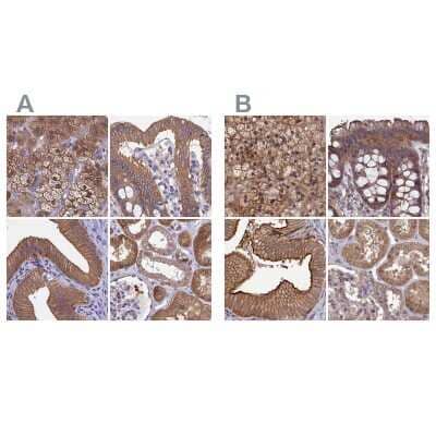 Immunohistochemistry-Paraffin: CHIP/STUB1 Antibody [NBP2-47510]