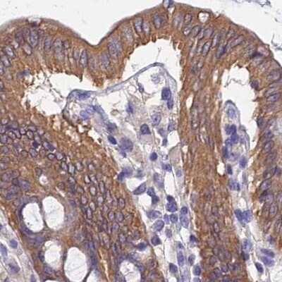 Immunohistochemistry-Paraffin: CHIP/STUB1 Antibody [NBP2-47510]