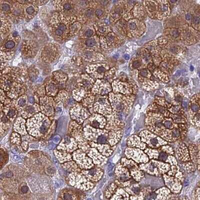 Immunohistochemistry-Paraffin: CHIP/STUB1 Antibody [NBP2-47510]