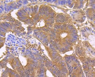 Immunohistochemistry-Paraffin: CHIP/STUB1 Antibody (JG38-22) [NBP2-75440]
