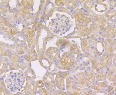 Immunohistochemistry-Paraffin: CHIP/STUB1 Antibody (JG38-22) [NBP2-75440]