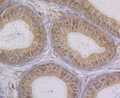 Immunohistochemistry-Paraffin: CHIP/STUB1 Antibody (JG38-22) [NBP2-75440]