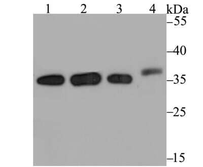 Western Blot: CHIP/STUB1 Antibody (JG38-22) [NBP2-75440]