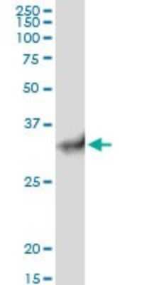 Western Blot: CHIP/STUB1 Antibody [H00010273-B01P]