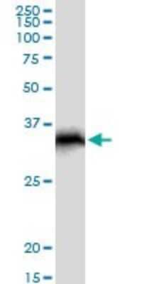 Western Blot: CHIP/STUB1 Antibody [H00010273-B01P]