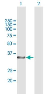 Western Blot: CHIP/STUB1 Antibody [H00010273-B01P]
