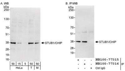 Western Blot: CHIP/STUB1 Antibody [NB100-77315]