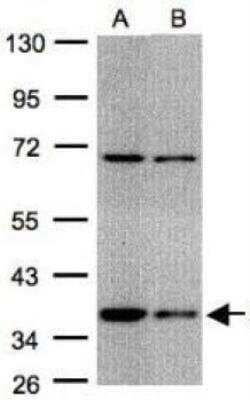 Western Blot: CHIP/STUB1 Antibody [NBP1-30936]