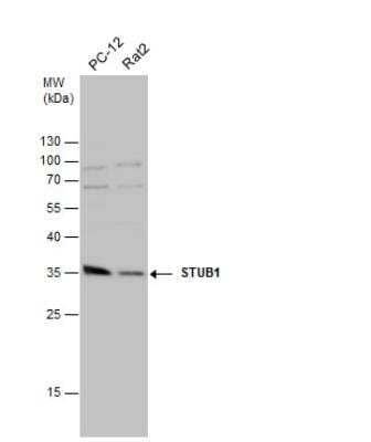 Western Blot: CHIP/STUB1 Antibody [NBP2-15882]