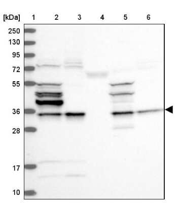 Western Blot: CHIP/STUB1 Antibody [NBP2-47510]