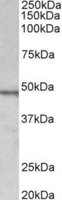 Western Blot: Chitotriosidase/CHIT1 Antibody [NBP1-97774]