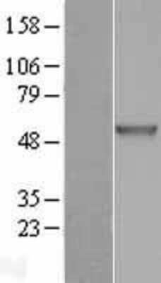 Western Blot: Chitotriosidase/CHIT1 Overexpression Lysate [NBL1-09156]