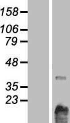 Western Blot: Choline Kinase beta Overexpression Lysate [NBP2-05413]