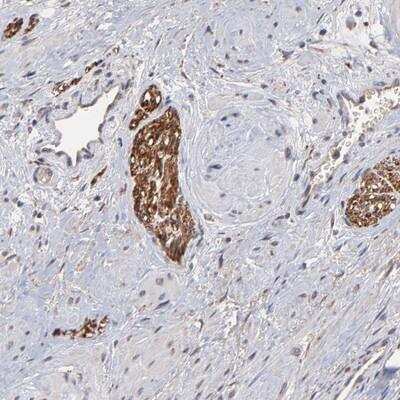 Immunohistochemistry: CHL-1/L1CAM-2 Antibody [NBP1-86660]