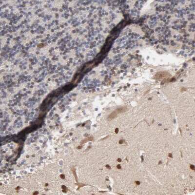 Immunohistochemistry-Paraffin: CHM Antibody [NBP1-84954]