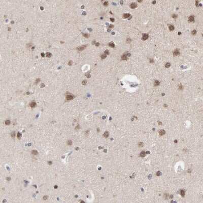 Immunohistochemistry-Paraffin: CHM Antibody [NBP1-84954]