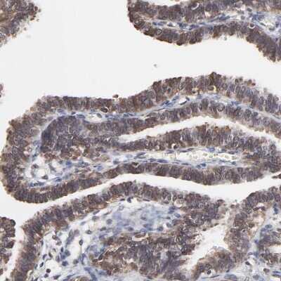 Immunohistochemistry-Paraffin: CHM Antibody [NBP1-84954]
