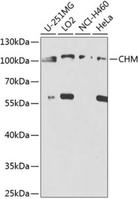 Western Blot: CHM AntibodyBSA Free [NBP2-92539]