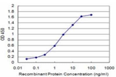 ELISA: CHML Antibody (5G4) [H00001122-M03]