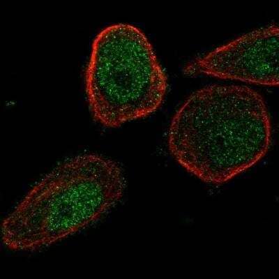 Immunocytochemistry/ Immunofluorescence: CHML Antibody [NBP2-76560]