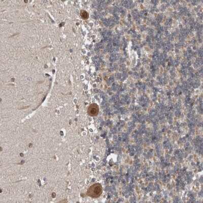 Immunohistochemistry-Paraffin: CHML Antibody [NBP1-87142]