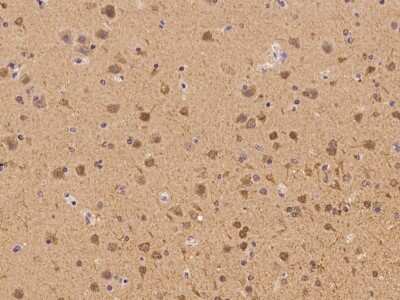 Immunohistochemistry-Paraffin: CHML Antibody [NBP2-98162]