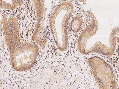 Immunohistochemistry-Paraffin: CHML Antibody [NBP2-98162]