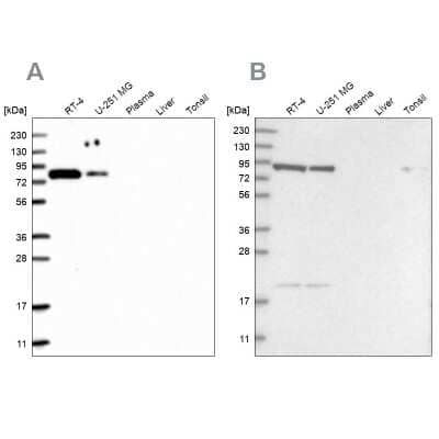 Western Blot: CHML Antibody [NBP2-76526]