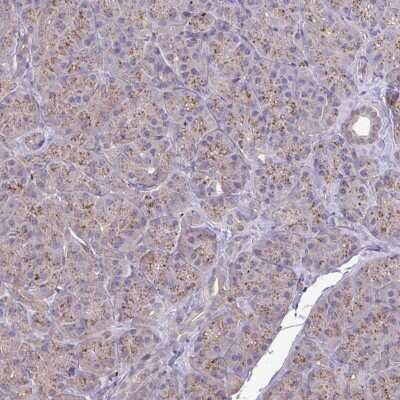 Immunohistochemistry: CHMP1B Antibody [NBP2-38007]
