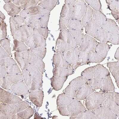 Immunohistochemistry-Paraffin: CHMP1B Antibody [NBP2-37986]