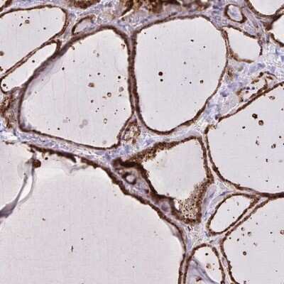 Immunohistochemistry-Paraffin: CHMP1B Antibody [NBP2-37986]