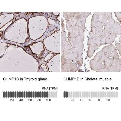 Immunohistochemistry-Paraffin: CHMP1B Antibody [NBP2-37986]