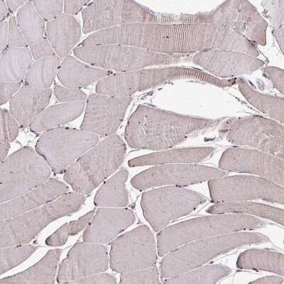 Immunohistochemistry-Paraffin: CHMP1B Antibody [NBP2-38007]