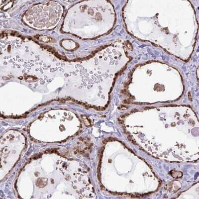 Immunohistochemistry-Paraffin: CHMP1B Antibody [NBP2-38007]