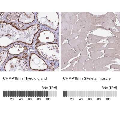 Immunohistochemistry-Paraffin: CHMP1B Antibody [NBP2-38007]
