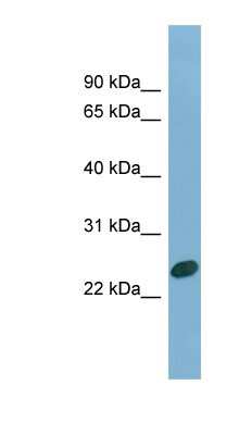 Western Blot: CHMP1B Antibody [NBP1-55512]