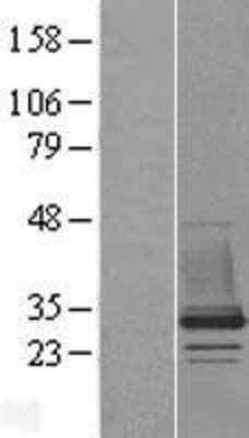 Western Blot: CHMP1B Overexpression Lysate [NBL1-09158]