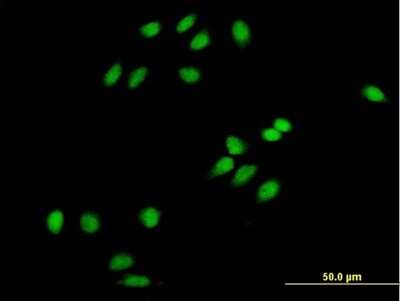 Immunocytochemistry/ Immunofluorescence: CHMP1a Antibody [H00005119-B02P]