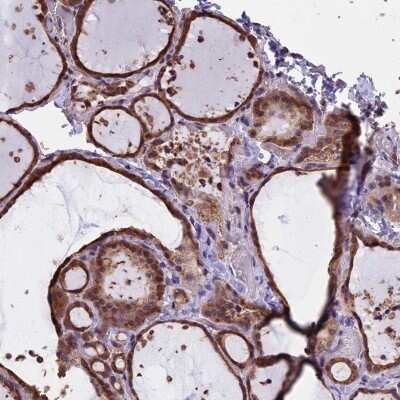 Immunohistochemistry-Paraffin: CHMP2A Antibody [NBP1-91780]