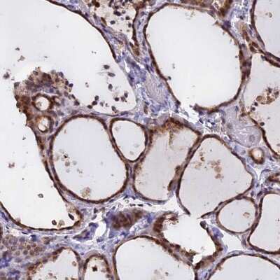 Immunohistochemistry-Paraffin: CHMP2A Antibody [NBP1-91781]