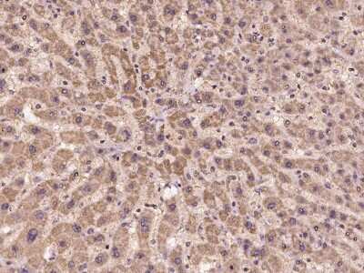 Immunohistochemistry-Paraffin: CHMP2A Antibody [NBP2-97282]