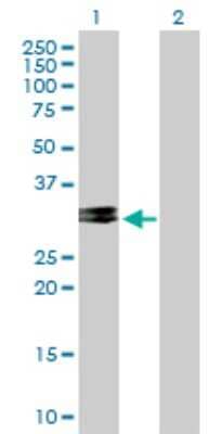 Western Blot: CHMP2A Antibody [H00027243-B01P]