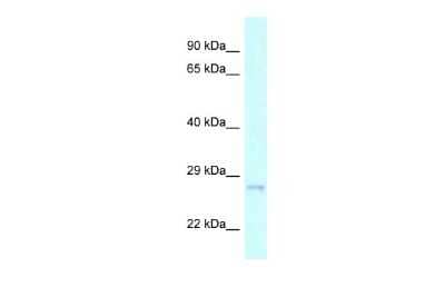 Western Blot: CHMP2A Antibody [NBP2-87182]