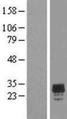 Western Blot: CHMP2A Overexpression Lysate [NBL1-09159]