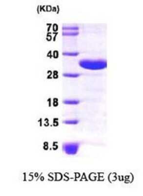 SDS-PAGE: Recombinant Human CHMP2A His Protein [NBP1-30206]